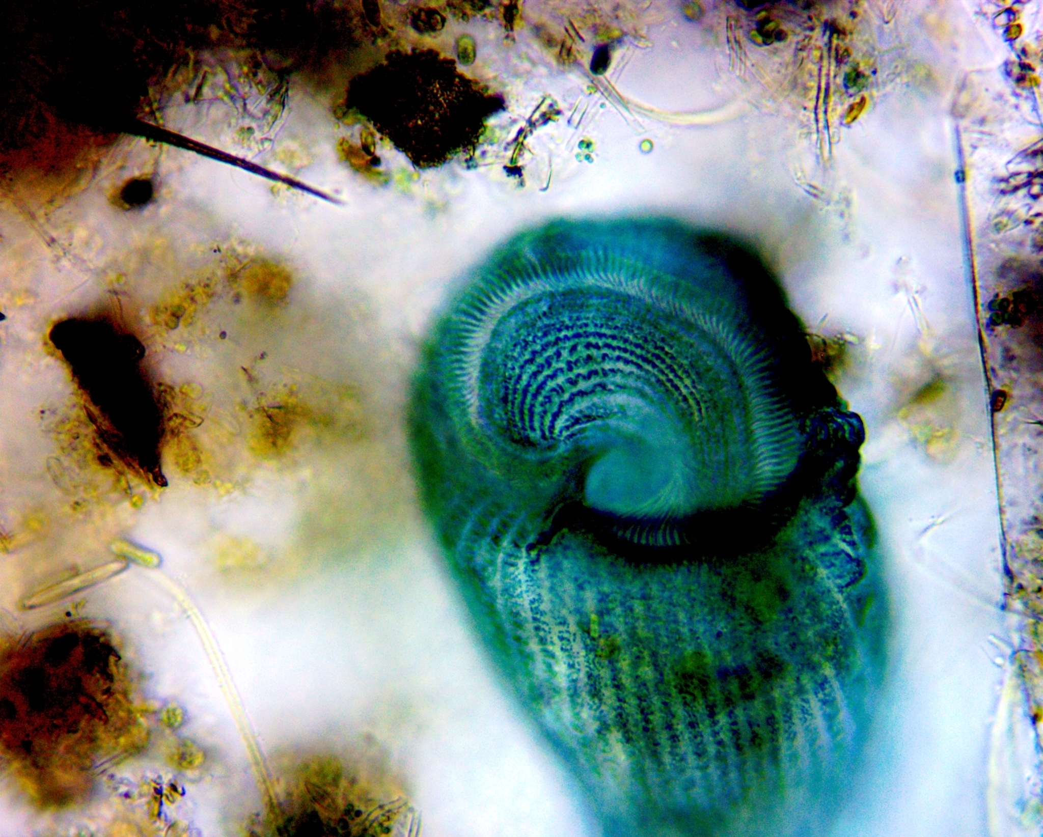 Stentor coeruleus